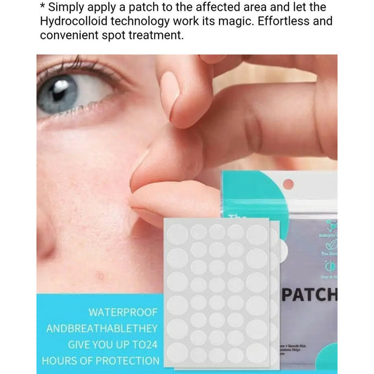 🔥🔥🔥 HYDROCOLLOID PIMPLE PATCHES ACNE PATCHES FOR FACE AND BODY 36 Count